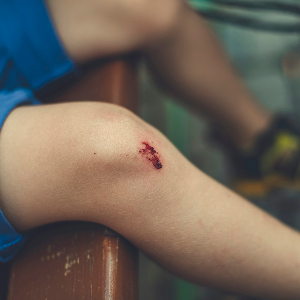 The first change was the body shot damage. It went from a near-guaranteed kill to a strong chunk of 
